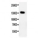 PTCH2 Antibody