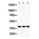 PTGER2  Antibody