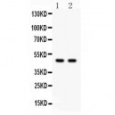 PTOV1 Antibody