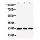 Rab11A Antibody