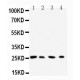 Rab3C Antibody