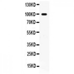 RANK  Antibody