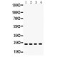 RBP4  Antibody