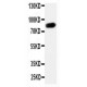 Reticulon 1 Antibody