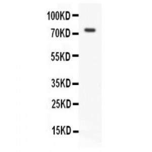 RIP Antibody