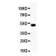 RUNX2  Antibody