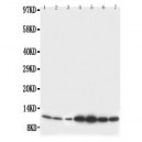 S100 beta Antibody