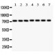 SDHA  Antibody