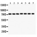 SDHA  Antibody