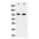 SDHA Antibody