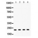 Securin Antibody