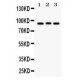 Semaphorin 3A  Antibody