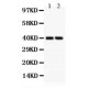 SFRP4 Antibody