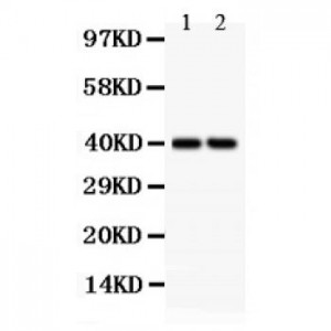 SFRP4 Antibody