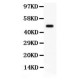 SGK1  Antibody