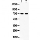 SHBG  Antibody