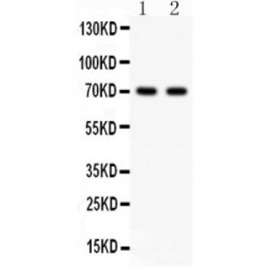 SHBG  Antibody