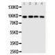 SIDT1 Antibody