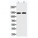 SLC12A6 Antibody