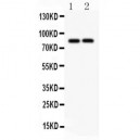 SLC15A2  Antibody