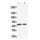 SLC22A1 Antibody