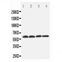 SLC22A7 Antibody