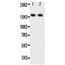 Smad Interacting Protein 1 Antibody