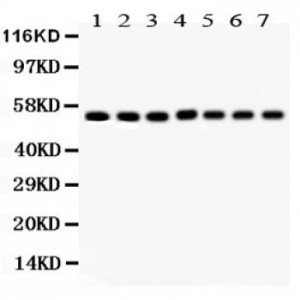 SMAD1/2/3/4/5  Antibody