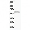 Smad4(DPC4) Antibody (monoclonal)