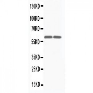 Smad4(DPC4) Antibody (monoclonal)