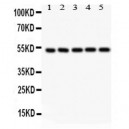 SMAD6  Antibody