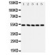 SMAD6 Antibody