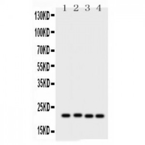 SOCS2  Antibody