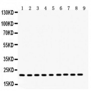 SOCS2 Antibody