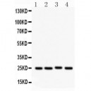 SOCS3  Antibody