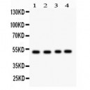 SOCS4  Antibody