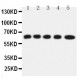 Solute carrier family 22 member 5 Antibody