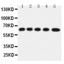 Solute carrier family 22 member 5 Antibody