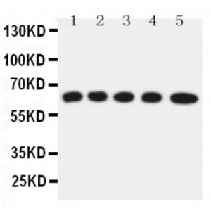 Solute carrier family 22 member 5 Antibody