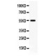 Somatostatin Receptor 2 Antibody