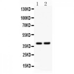 SOX1  Antibody