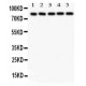 SOX5  Antibody