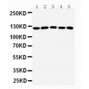 ST5 Antibody