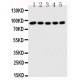 STAT1 Antibody