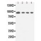 STAT5a Antibody