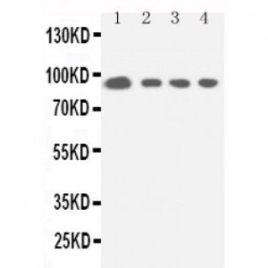 STAT5a Antibody