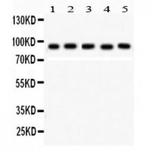 STAT5b  Antibody