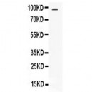 STAT6  Antibody