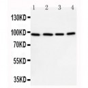 STAT6 Antibody