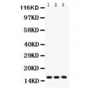 Survivin Antibody